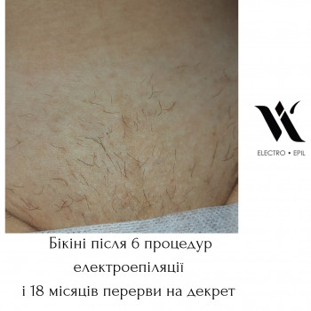 Ілона Волянська, Хмельницкий Фото - 19