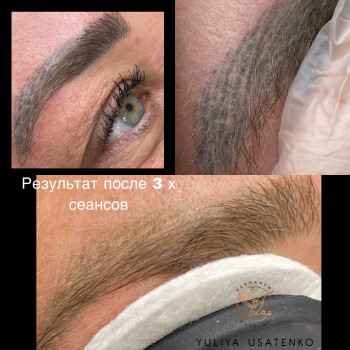 Лазерне видалення татуажу та тату
                    Майстер перманентного макіяжу Юлия Запоріжжя