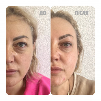 Оксана Гукалюк, Київ Фото - 16