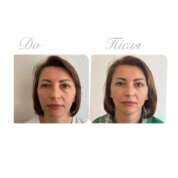 Оксана Гукалюк, Київ Фото - 14