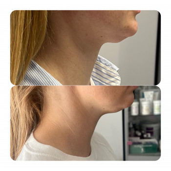 Оксана Гукалюк, Київ Фото - 10