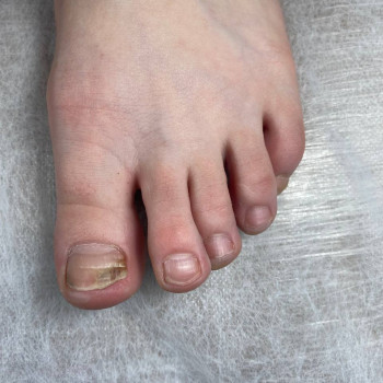 Подологічний педикюр
                    Майстер манікюру Вікторія Кам'янське