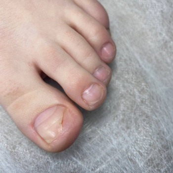 Подологічний педикюр
                    Майстер манікюру Вікторія Кам'янське