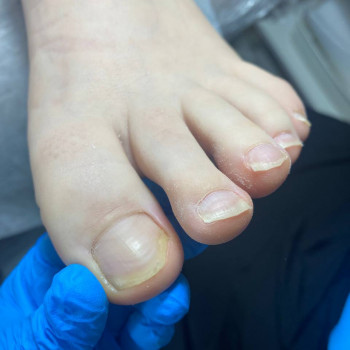 Подологічний педикюр
                    Майстер манікюру Вікторія Кам'янське