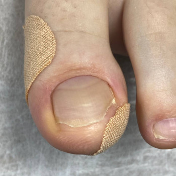 Подологічний педикюр
                    Майстер манікюру Вікторія Кам'янське