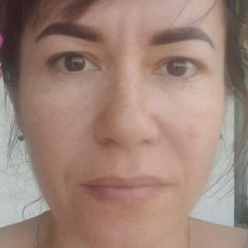 Фото клієнта, другий день після процедури