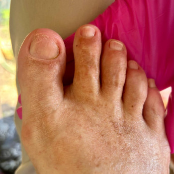 Фото из портфолио специалиста Татьяна Вакула (подолог, Харьков)