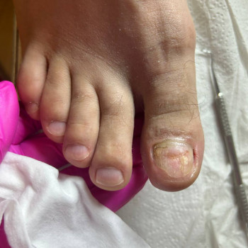 Фото из портфолио специалиста Татьяна Вакула (подолог, Харьков)