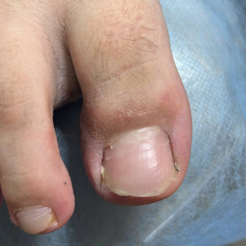 Фото из портфолио специалиста Татьяна Вакула (подолог, Харьков)