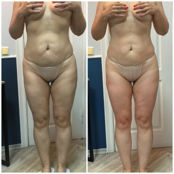 Massage Studio, Киев Фото - 6