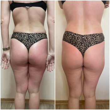 Наталя Кудряшова, Чернівці Фото - 36