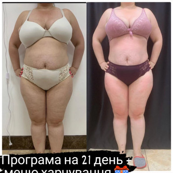 Наталя Кудряшова, Чернівці Фото - 37