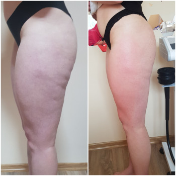 Наталя Кудряшова, Чернівці Фото - 38