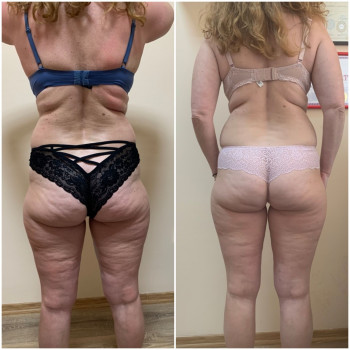 Наталя Кудряшова, Чернівці Фото - 39