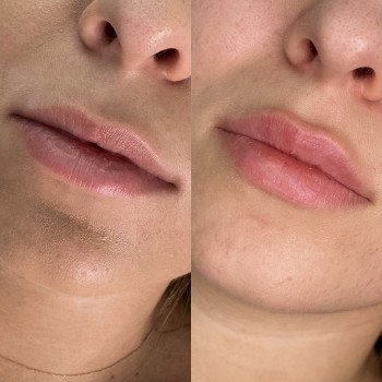 Катерина Труш, Київ Фото - 7