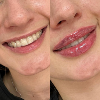 Катерина Труш, Київ Фото - 8