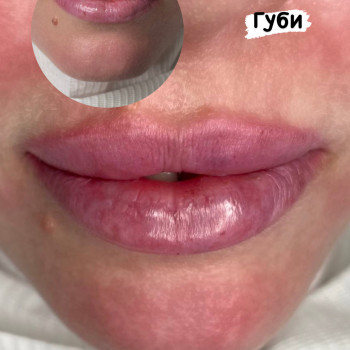 Янітта Б, Вышгород Фото - 7