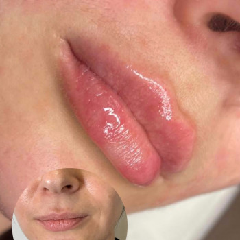 Янітта Б, Вышгород Фото - 10