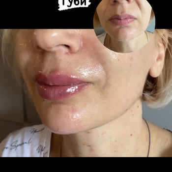 Янітта Б, Вышгород Фото - 12