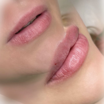 Янітта Б, Вышгород Фото - 15