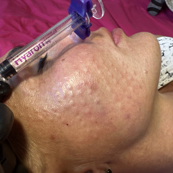 Янітта Б, Вышгород Фото - 16