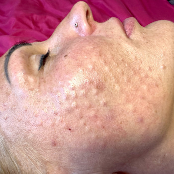 Янітта Б, Вышгород Фото - 18