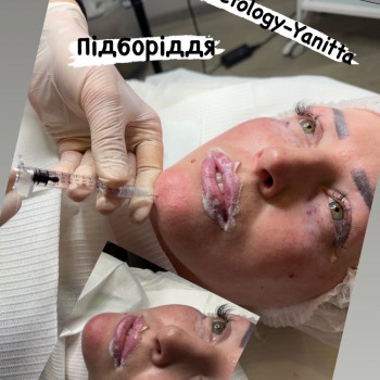 Янітта Б, Вышгород Фото - 19