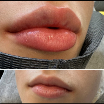 Янітта Б, Вышгород Фото - 20