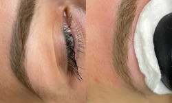 Удаление лазером татуажа, тату Мастер перманентного макияжа Анна Каменское