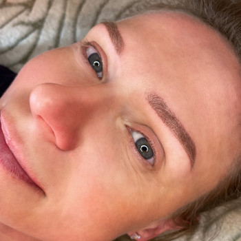 4. Після процедури