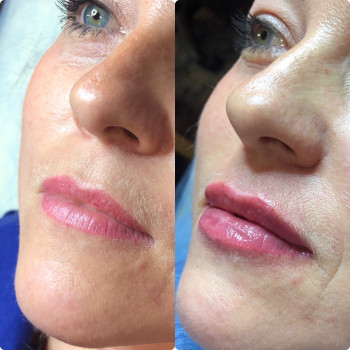 Віта Сокирко, Київ Фото - 13