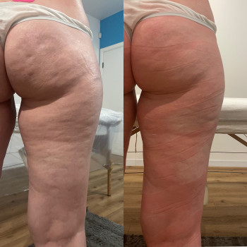 Результат від 1 процедури