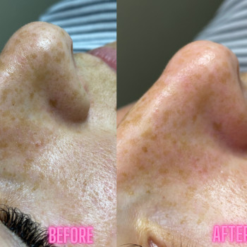 Аліна Лейченко, Рівне Фото - 9