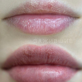 Загоєний перманентний макіяж губ в акварельній техніки.