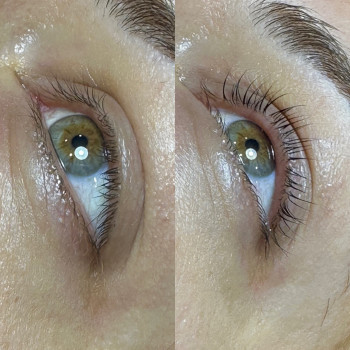 ЛамIнування вIй