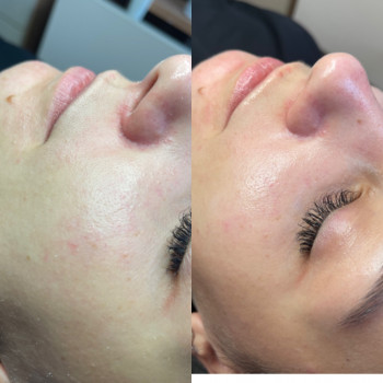 Ирина Борозенец, Киев Фото - 7