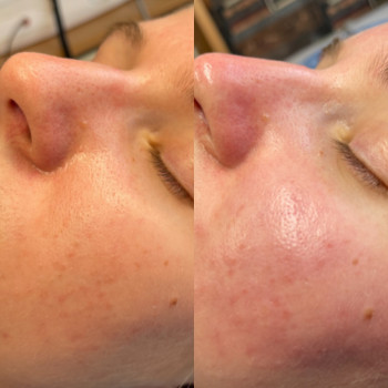 Ирина Борозенец, Киев Фото - 8