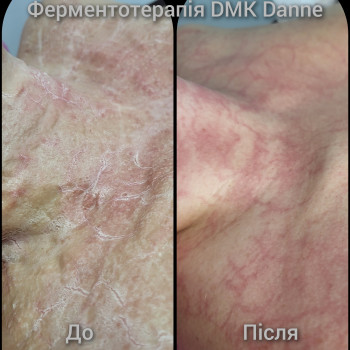 Ирина Драч, Киев Фото - 5