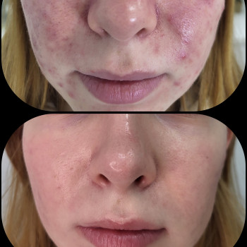 Ирина Драч, Киев Фото - 6