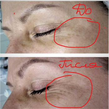 Людмила Нишенко-Зубковская , Бровари Фото - 12