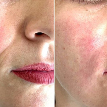 Людмила Нишенко-Зубковская , Бровари Фото - 13