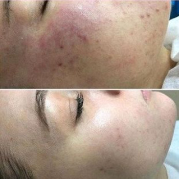 Людмила Нишенко-Зубковская , Бровари Фото - 16