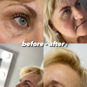 Юлія Григоренко, Чернівці Фото - 74