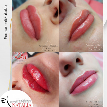 Корекція перманентного макіяжу губ після основної процедури.
   