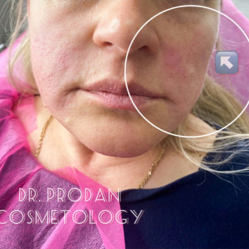 Вікторія Продан, Чернівці Фото - 6