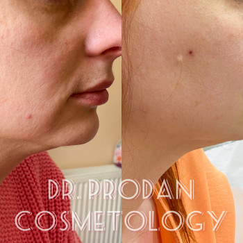 Вікторія Продан, Чернівці Фото - 9