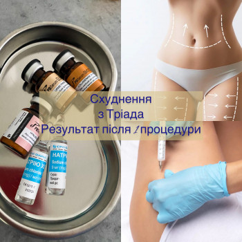 Вікторія Продан, Чернівці Фото - 10