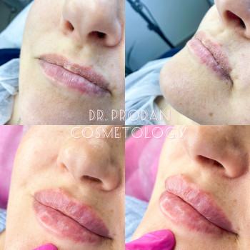 Вікторія Продан, Чернівці Фото - 11