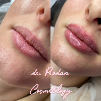 Вікторія Продан, Чернівці Фото - 12