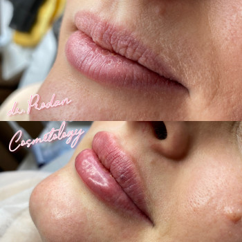 Вікторія Продан, Чернівці Фото - 13